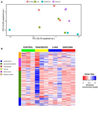 Growth of Malignant Non-CNS Tumors Alters Brain Metabolome